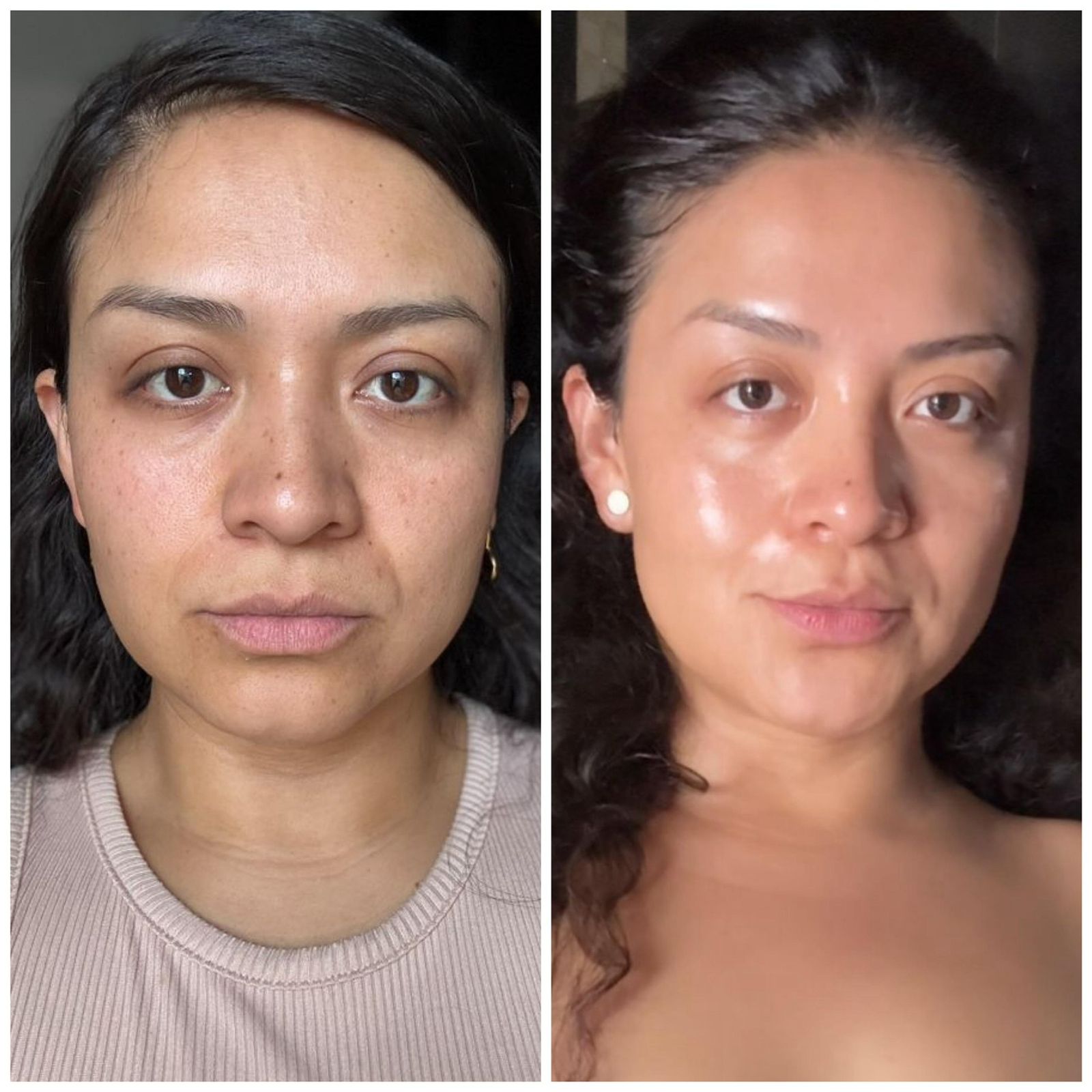 Antes y después facial con piel más luminosa y tono más uniforme.