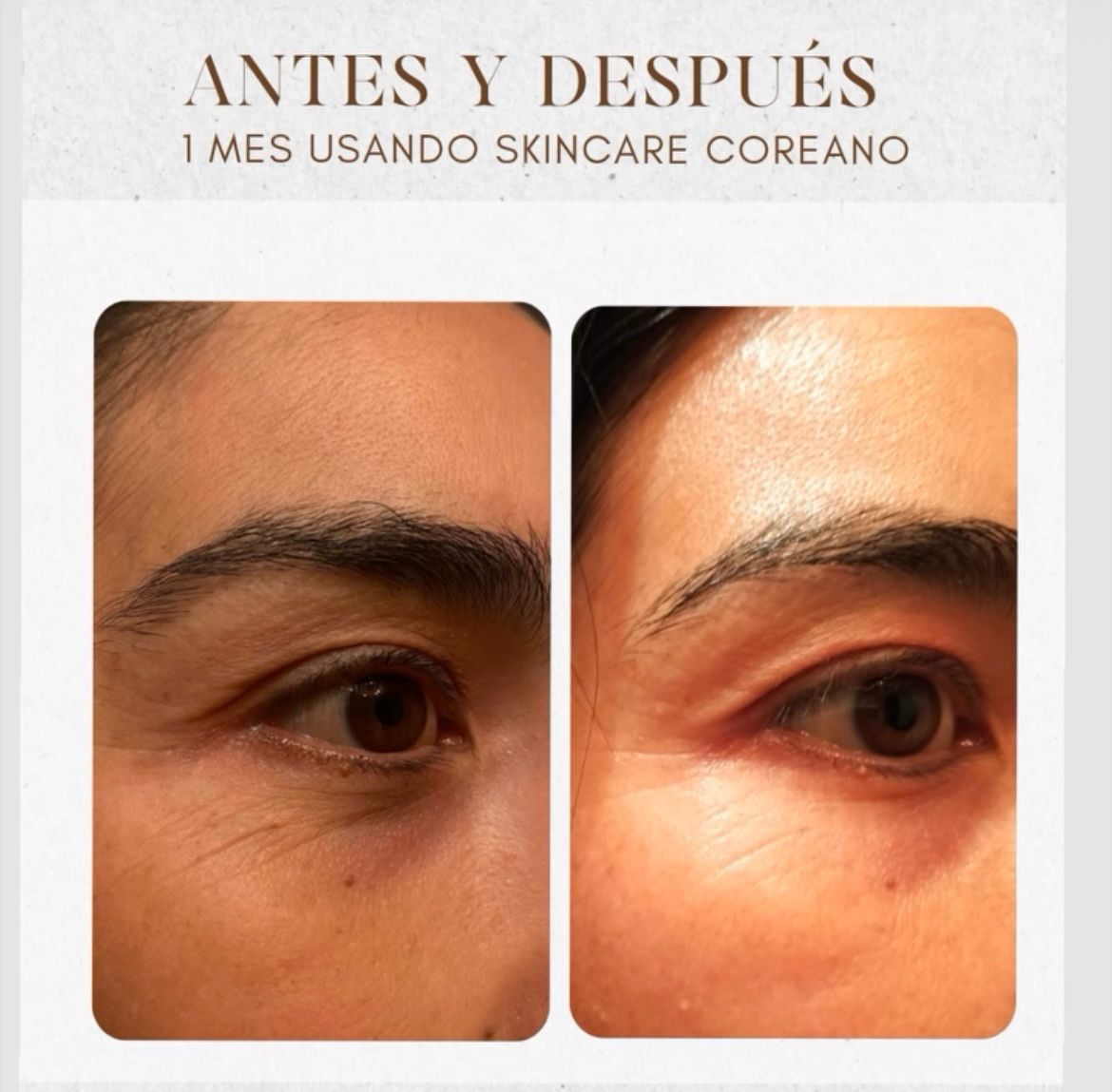 Antes y después de zona de ojos tras un mes de skincare coreano.